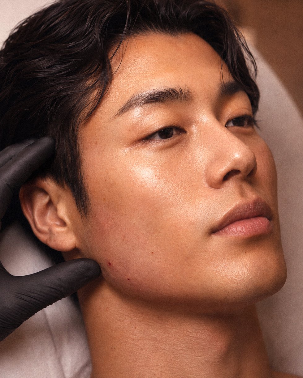 Armonización facial
