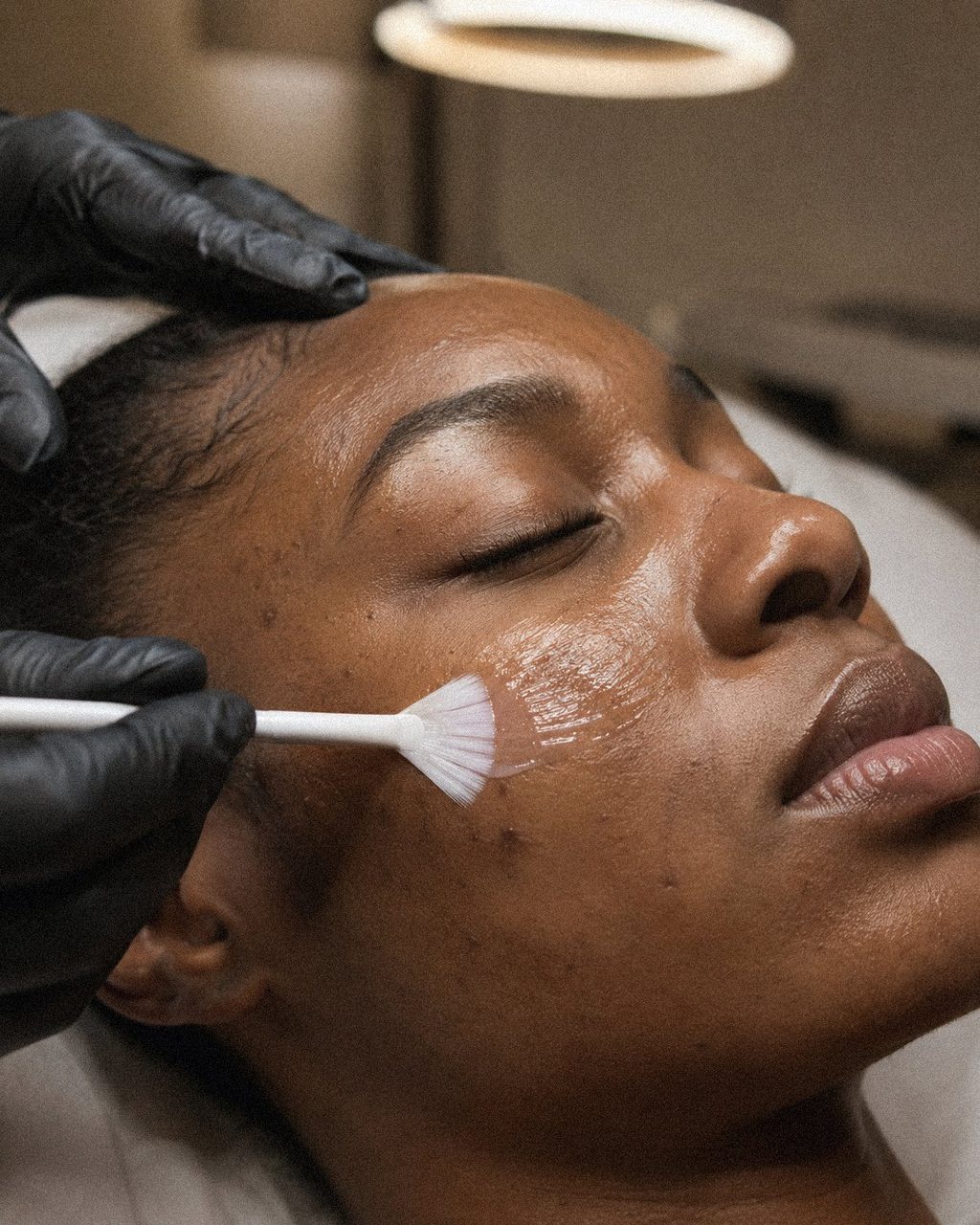 Tratamiento facial